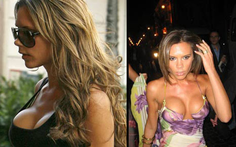 海南在线新闻中心-<em>辣妹</em>惊爆再次<em>隆胸</em> 双球安